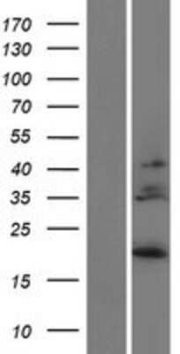 Western Blot: IL28B Overexpression Lysate (Adult Normal) [NBP2-05198] Left-Empty vector transfected control cell lysate (HEK293 cell lysate); Right -Over-expression Lysate for IL28B.