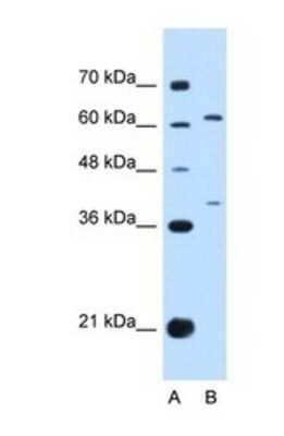 Western Blot: IL28RA Antibody [NBP1-69636] - This Anti-IL28RA antibody was used in Western Blot of HepG2 tissue lysate at a concentration of 1ug/ml.