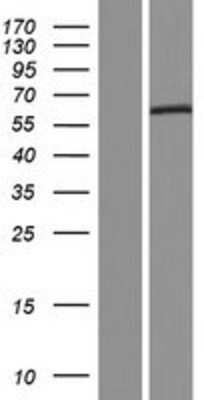 Western Blot: IL28RA Overexpression Lysate (Adult Normal) [NBP2-05147] Left-Empty vector transfected control cell lysate (HEK293 cell lysate); Right -Over-expression Lysate for IL28RA.