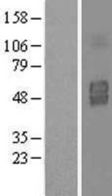 Western Blot: IL3RA Overexpression Lysate (Adult Normal) [NBL1-11956] Left-Empty vector transfected control cell lysate (HEK293 cell lysate); Right -Over-expression Lysate for IL3RA.