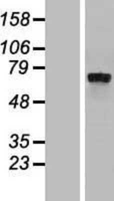 Western Blot: IL4I1 Overexpression Lysate (Adult Normal) [NBP2-05157] Left-Empty vector transfected control cell lysate (HEK293 cell lysate); Right -Over-expression Lysate for IL4I1.