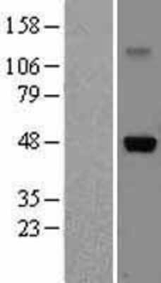 Western Blot: IL5RA Overexpression Lysate (Adult Normal) [NBL1-11960] Left-Empty vector transfected control cell lysate (HEK293 cell lysate); Right -Over-expression Lysate for IL5RA.