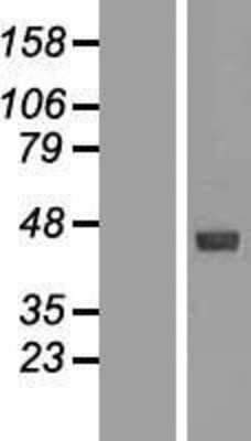 Western Blot: IL5RA Overexpression Lysate (Adult Normal) [NBL1-11961] Left-Empty vector transfected control cell lysate (HEK293 cell lysate); Right -Over-expression Lysate for IL5RA.