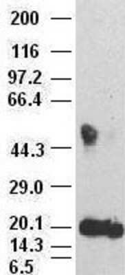 Western Blot: IL6 Antibody (3G9) [NBP1-47810] - IL6 antibody (3G9) at 1:500000 + recombinant human IL6 IL6 antibody (2G3) at 1:2000