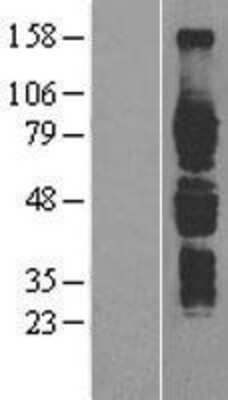 Western Blot: IL6R Overexpression Lysate (Adult Normal) [NBP2-04164] Left-Empty vector transfected control cell lysate (HEK293 cell lysate); Right -Over-expression Lysate for IL6R.