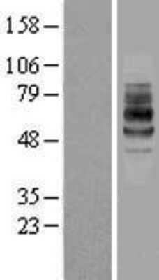 Western Blot: IL7 Receptor alpha Overexpression Lysate (Adult Normal) [NBL1-11966] Left-Empty vector transfected control cell lysate (HEK293 cell lysate); Right -Over-expression Lysate for IL7 Receptor alpha.