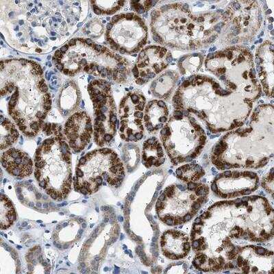 Immunohistochemistry-Paraffin ILDR1 Antibody - BSA Free