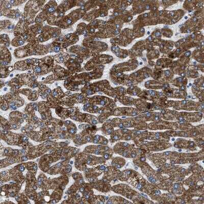 Immunohistochemistry-Paraffin ILDR1 Antibody - BSA Free