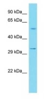 Western Blot: ILDR2 Antibody [NBP3-09736] - Western blot analysis of ILDR2 in Human 721_B Whole Cell. Antibody dilution at 1ug/ml
