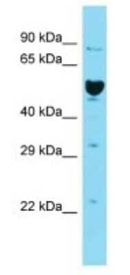 Western Blot: ILDR2 Antibody [NBP3-09737] - Western blot analysis of ILDR2 in Human 721_B Whole Cell. Antibody dilution at 1ug/ml