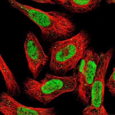 Immunocytochemistry/Immunofluorescence: ILF1 Antibody [NBP1-87700] - Staining of human cell line U-2 OS shows localization to nucleoplasm & vesicles. Antibody staining is shown in green.