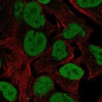 Immunocytochemistry/Immunofluorescence: ILF1 Antibody [NBP3-17725] - Staining of human cell line SK-MEL-30 shows localization to nucleoplasm & vesicles.