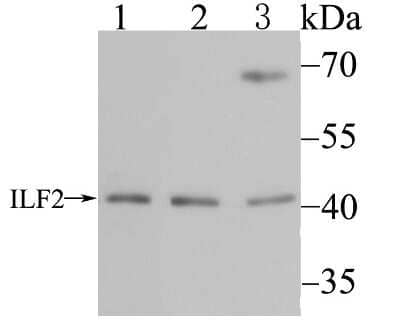 Western Blot: ILF2 Antibody (JU50-33) [NBP2-75539] - Analysis of ILF2 on different cell lysates using anti-ILF2 antibody at 1/500 dilution.Positive control:Lane 1: Mouse testis tissue    Lane 2: HL-60Lane 3: SH-SY-5Y
