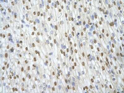 Immunohistochemistry: ILF3 Antibody [NBP1-58226] - Paraffin Embedded Tissue: Human Heart cell Cellular Data: cardiac cell of renal tubule Antibody Concentration: 4.0 - 8.0 ug/ml Magnification: 400X