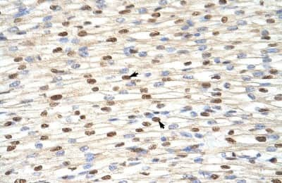 Immunohistochemistry: ILF3 Antibody [NBP1-58226] - Paraffin Embedded Tissue: Human Heart Cellular Data: Myocardial cells Antibody Concentration: 4.0 - 8.0 ug/ml Magnification: 400X