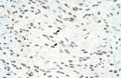 Immunohistochemistry-Paraffin: ILF3 Antibody [NBP1-58225] - Human Muscle Tissue, Skeletal muscle cells (Indicated with Arrows) 4-8ug/ml.