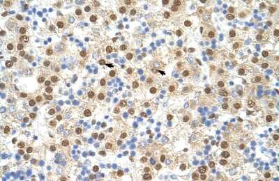 Immunohistochemistry-Paraffin: ILF3 Antibody [NBP1-58226] - Human Liver Tissue, antibody concentration 4-8ug/ml. Cells with positive label: Hepatocytes (indicated with arrows) 400X magnification.