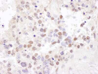 Immunohistochemistry-Paraffin: ILF3 Antibody [NBP1-71876] - Sample: FFPE section of mouse teratoma. Antibody: Affinity purified rabbit anti- NF90/NF110 used at a dilution of 1:200 (1ug/ml). Detection: DAB