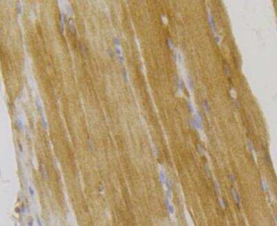 Immunohistochemistry-Paraffin: ILK Antibody [NBP2-89110] - Analysis of paraffin-embedded rat skeletal muscle tissue using anti-Integrin linked ILK antibody. The section was pre-treated using heat mediated antigen retrieval with Tris-EDTA buffer (pH 8.0-8.4) for 20 minutes.The tissues were blocked in 5% BSA for 30 minutes at room temperature, washed with ddH2O and PBS, and then probed with the antibody at 1/200 dilution, for 30 minutes at room temperature and detected using an HRP conjugated compact polymer system. DAB was used as the chrogen. Counter stained with hematoxylin and mounted with DPX.