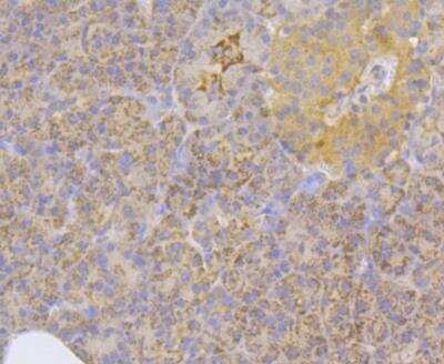 Immunohistochemistry-Paraffin: ILK Antibody [NBP2-89110] - Analysis of paraffin-embedded human pancreas tissue using anti-Integrin linked ILK antibody. The section was pre-treated using heat mediated antigen retrieval with Tris-EDTA buffer (pH 8.0-8.4) for 20 minutes.The tissues were blocked in 5% BSA for 30 minutes at room temperature, washed with ddH2O and PBS, and then probed with the antibody at 1/200 dilution, for 30 minutes at room temperature and detected using an HRP conjugated compact polymer system. DAB was used as the chrogen. Counter stained with hematoxylin and mounted with DPX.