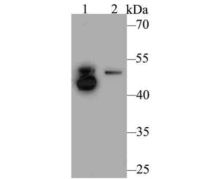Western Blot: ILK Antibody [NBP2-89110] - Analysis of Integrin linked ILK on different lysates. Proteins were transferred to a PVDF membrane and blocked with 5% BSA in PBS for 1 hour at room temperature. The primary antibody was used at a 1:500 dilution in 5% BSA at room temperature for 2 hours. Goat Anti-Rabbit IgG - HRP Secondary Antibody at 1:5,000 dilution was used for 1 hour at room temperature.Positive control: Lane 1: Mouse skeletal muscle tissue lysateLane 2: Rat lung tissue lysate