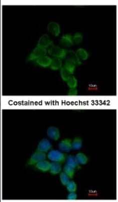 Immunocytochemistry/Immunofluorescence: ILKAP Antibody [NBP2-16960] - Immunofluorescence analysis of methanol-fixed MCF-7, using antibody at 1:200 dilution.