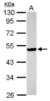 Western Blot: ILKAP Antibody [NBP2-16960] - Sample (30 ug of whole cell lysate) A: MCF-7 10% SDS PAGE gel, diluted at 1:1000.
