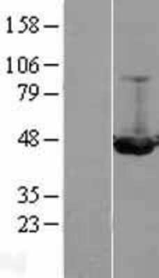 Western Blot: ILKAP Overexpression Lysate (Adult Normal) [NBL1-11976] Left-Empty vector transfected control cell lysate (HEK293 cell lysate); Right -Over-expression Lysate for ILKAP.