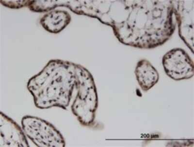 Immunohistochemistry-Paraffin: ILKAP/PP2C delta Antibody (3B5) [H00080895-M02] - Analysis of monoclonal antibody to ILKAP on formalin-fixed paraffin-embedded human placenta. Antibody concentration 3 ug/ml.