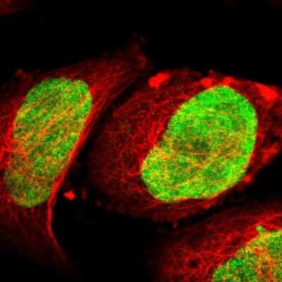 Immunocytochemistry/Immunofluorescence: ILKAP/PP2C delta Antibody [NBP1-85117] - Staining of human cell line A-431 shows localization to nucleus.