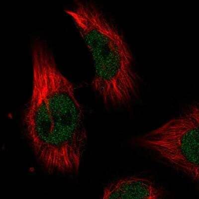 Immunocytochemistry/Immunofluorescence: ILKAP/PP2C delta Antibody [NBP2-76549] - Staining of human cell line U-251 MG shows localization to nucleoplasm. Antibody staining is shown in green.