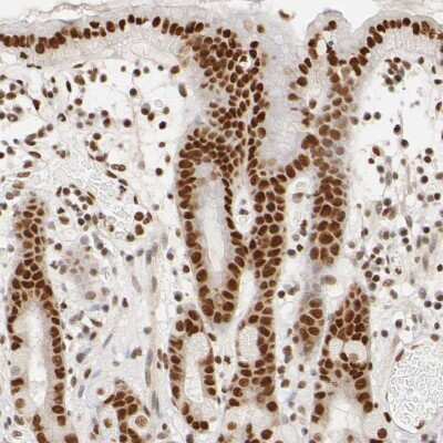 Immunohistochemistry-Paraffin: ILKAP/PP2C delta Antibody [NBP1-85117] - Staining of human stomach shows strong nuclear positivity in glandular cells.