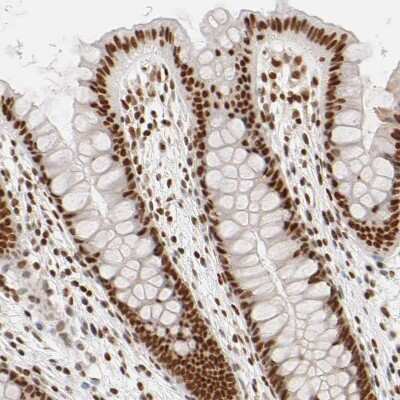 Immunohistochemistry-Paraffin: ILKAP/PP2C delta Antibody [NBP1-85117] - Staining of human colon shows strong nuclear positivity in glandular cells.