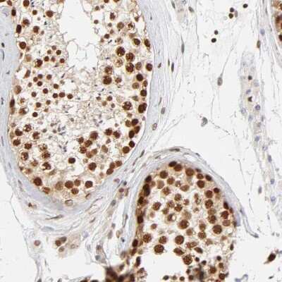 Immunohistochemistry-Paraffin: ILKAP/PP2C delta Antibody [NBP1-85117] - Staining of human testis shows strong nuclear positivity in cells in seminiferous ducts.