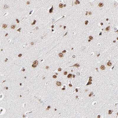 Immunohistochemistry-Paraffin: ILKAP/PP2C delta Antibody [NBP1-85117] - Staining of human cerebral cortex shows strong nuclear positivity in neurons.