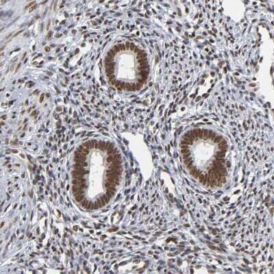 Immunohistochemistry-Paraffin: ILKAP/PP2C delta Antibody [NBP1-85117] - Staining of human endometrium shows strong nuclear positivity in glandular cells.