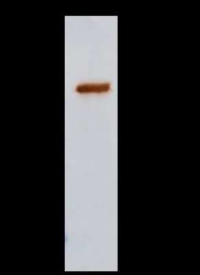 Immunoprecipitation: ILKAP/PP2C delta Antibody [NBP3-00036] - ILKAP/PP2C delta was immunoprecipitated using: Lane A: 0.5 mg 293T Whole Cell Lysate 2 ul anti-ILKAP/PP2C delta rabbit polyclonal antibody and 15 ul of 50 % Protein G agarose. Primary antibody: Anti-ILKAP/PP2C delta rabbit polyclonal antibody, at 1:200 dilution. Secondary antibody: Clean-Bloto IP Detection Reagent (HRP) at 1:1000 dilution. Developed using the DAB staining technique. Performed under reducing conditions. Predicted band size: 43 kDa. Observed band size: 43 kDa
