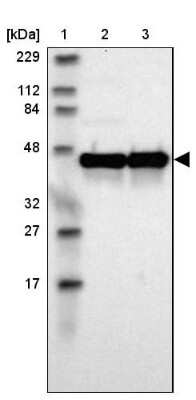 Western Blot: ILKAP/PP2C delta Antibody [NBP1-85117] - Lane 1: Marker  [kDa] 229, 112, 84, 48, 32, 27, 17.  Lane 2: Human cell line RT-4.  Lane 3: Human cell line U-251MG sp