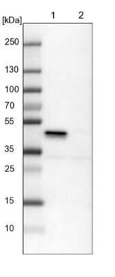 Western Blot ILKAP/PP2C delta Antibody - BSA Free
