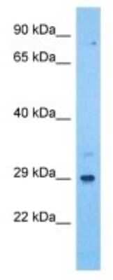 Western Blot: ILT11/LILRA5 Antibody [NBP3-10013] - Western blot analysis of ILT11/LILRA5 in Human 293T Whole Cell. Antibody dilution at 1.0ug/ml