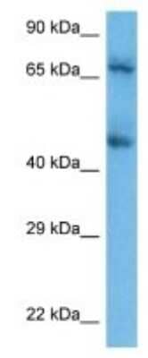 Western Blot: ILT3/CD85k/LILRB4 Antibody [NBP3-09945] - Western blot analysis of ILT3/CD85k/LILRB4 in Human OVCAR-3 Whole Cell. Antibody dilution at 1 ug/mL