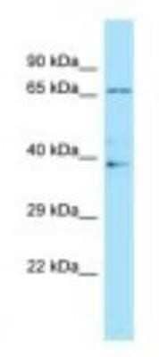 Western Blot: ILT4/CD85d/LILRB2 Antibody [NBP1-98554] - Human Fetal Brain Lysate 1.0ug/ml, Gel Concentration: 12%