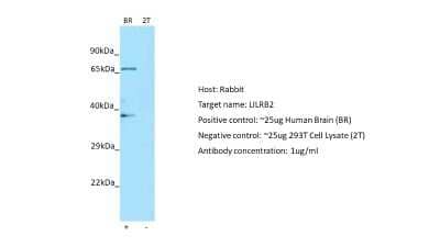 Western Blot: ILT4/CD85d/LILRB2 Antibody [NBP1-98554] - Host: Rabbit. Target: LILRB2. Positive control (+): Human brain (BR). Negative control (-): 293T (2T). Antibody concentration: 1ug/ml