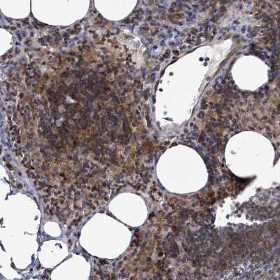 Immunohistochemistry-Paraffin: ILT7/CD85g/LILRA4 Antibody [NBP2-48932] - Staining of human lymph node shows moderate to strong positivity in lymphoid cells.