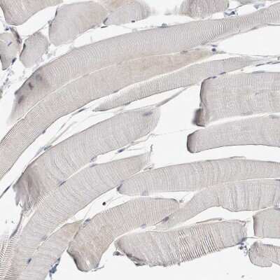 Immunohistochemistry-Paraffin: ILT7/CD85g/LILRA4 Antibody [NBP2-48932] - Staining of human skeletal muscle shows no positivity in myocytes as expected.