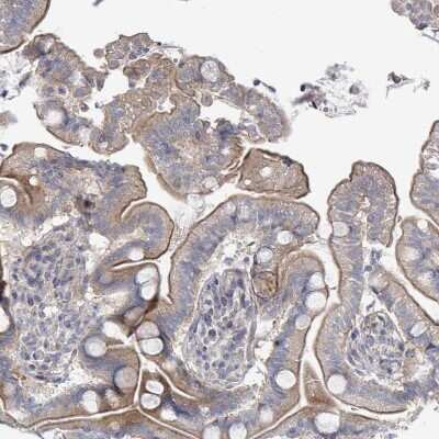 Immunohistochemistry-Paraffin: ILT7/CD85g/LILRA4 Antibody [NBP2-48932] - Staining of human small intestine shows moderate membranous positivity in glandular cells.