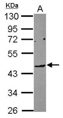 Western Blot: ILT7/CD85g/LILRA4 Antibody [NBP2-15012] - Sample (30 ug of whole cell lysate) A: Raji 10% SDS PAGE diluted at 1:1000 