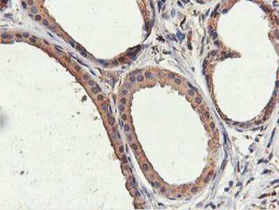 Immunohistochemistry-Paraffin: ILVBL Antibody (8B12) [NBP2-00883] - Staining of paraffin-embedded Human breast tissue using anti-ILVBL mouse monoclonal antibody.