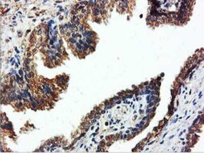 Immunohistochemistry: ILVBL Antibody (OTI8B12) - Azide and BSA Free [NBP2-71661] - Staining of paraffin-embedded Human prostate tissue using anti-ILVBL mouse monoclonal antibody.