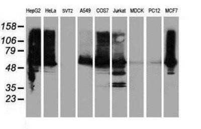 Western Blot: ILVBL Antibody (OTI8B12) - Azide and BSA Free [NBP2-71661] - Analysis of extracts (35ug) from 9 different cell lines by using anti-ILVBL monoclonal antibody.
